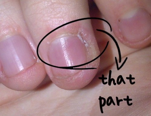 6 essential steps for the skin around your nails